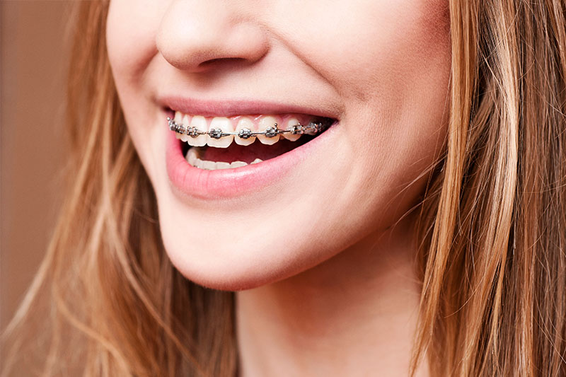 Orthodontics in Munster