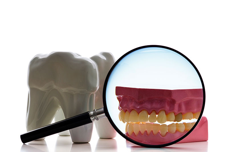 Root Canal in Munster